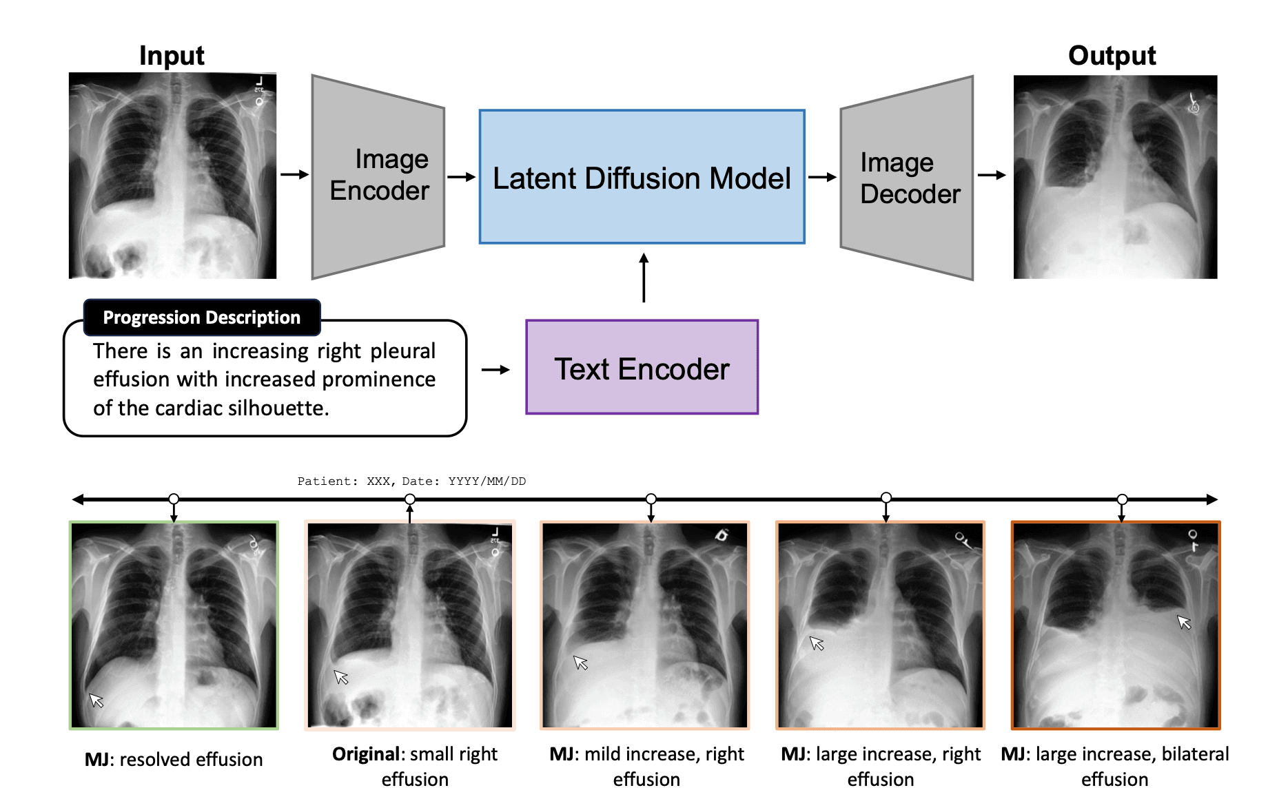 Biomedjourney: Counterfactual biomedical image generation by instruction-learning from multimodal patient journeys